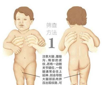 澳门 威尼斯游戏平台检测宝宝的骨密度